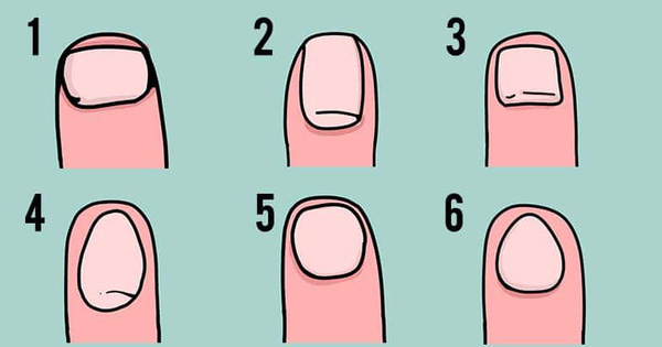 Quiz: Hoá ra hình dáng móng tay lại tiết lộ nét tính cách bí mật bên trong mỗi người, thử ngay vì kết quả sẽ khiến bạn bất ngờ