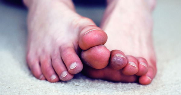 5 triệu chứng ở chân cho thấy cơ thể bạn đang trên đà lão hóa, mắc phải dù chỉ 1 cái cũng đã rất đáng lo