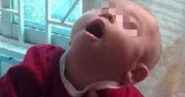 Bé gái 8 tháng tuổi bị bại não vì ông bà nội bế trên tay rung lắc cho cháu ngủ trong một thời gian dài