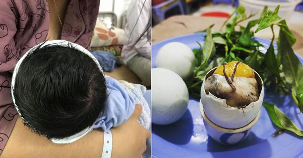 Bố khoe con "rậm tóc" nhờ vợ ăn nhiều trứng vịt lộn khi mang bầu, sự thật thế nào?
