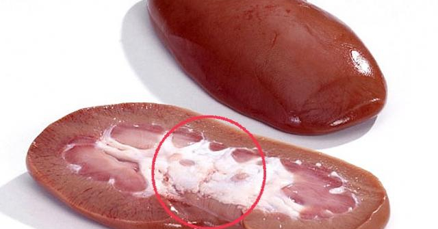 5 bộ phận bẩn nhất của lợn nhưng nhiều người thích ăn, cẩn thận kẻo "hối không kịp"