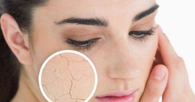 Mỹ phẩm Ricskin - Kohinoor chia sẻ 3 dấu hiệu cho thấy da mặt đang thiếu ẩm trầm trọng