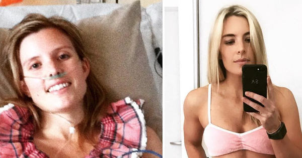 Đau bụng từ năm 16 tuổi nhưng 6 năm sau cô gái mới được bác sĩ chẩn đoán đúng bệnh: Nhìn vào tấm hình chụp bên trong cơ thể, mọi thứ thật kinh khủng