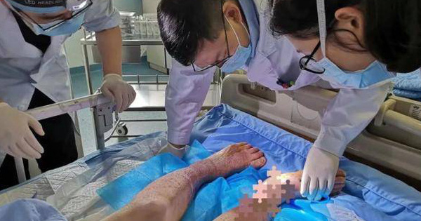 Cả 2 chân của người đàn ông bị lở loét, hoại tử, phải cắt cụt chỉ vì ngâm chân, bác sĩ nhắc nhở 4 nhóm người đừng dại dột mà làm vậy kẻo mang bệnh vào người