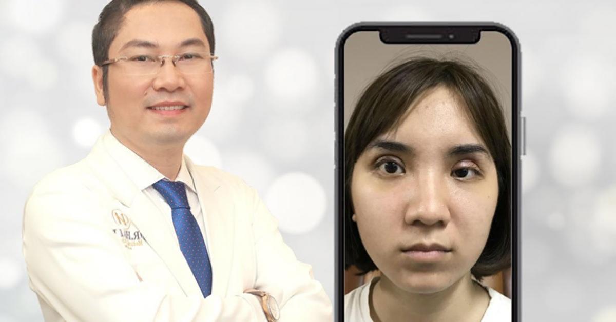 Dr.Hải Lê: Địa chỉ sửa mí mắt lỗi hỏng an toàn và uy tín tại Hà Nội