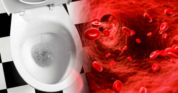 3 hiện tượng lạ khi đi vệ sinh là dấu hiệu tế bào ung thư đang nhen nhóm, đừng chủ quan bỏ qua