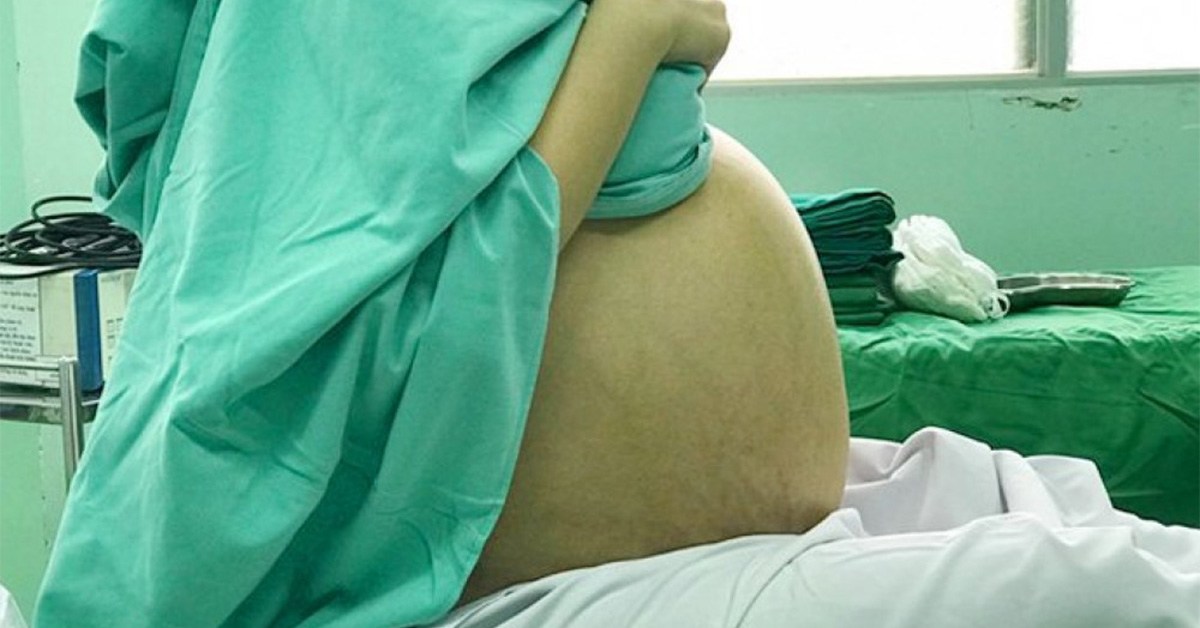 Đi siêu âm y tá cứ thì thầm to nhỏ, mẹ bầu không ngờ sinh con chấn động thế giới