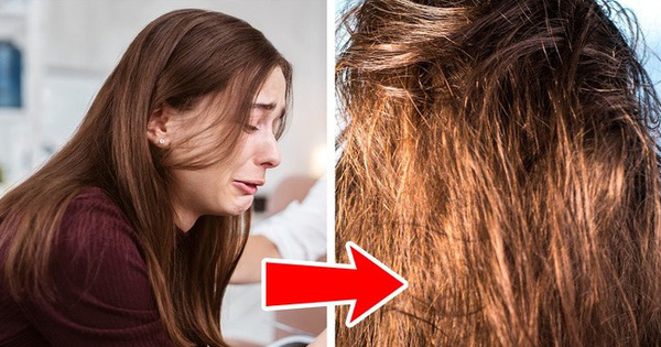 Vừa gội đầu sạch sẽ được 1 ngày tóc đã lại bết? Đây là 4 nguyên nhân dẫn tới tình trạng đầu tóc "chim sẻ đi mưa" của chị em